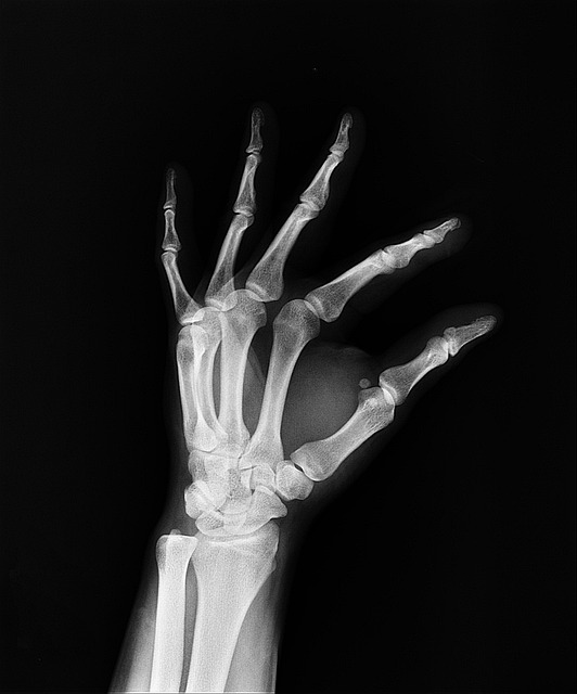 Arm Treatment,Results Display