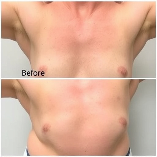 Underarm Treatment,Results Photo