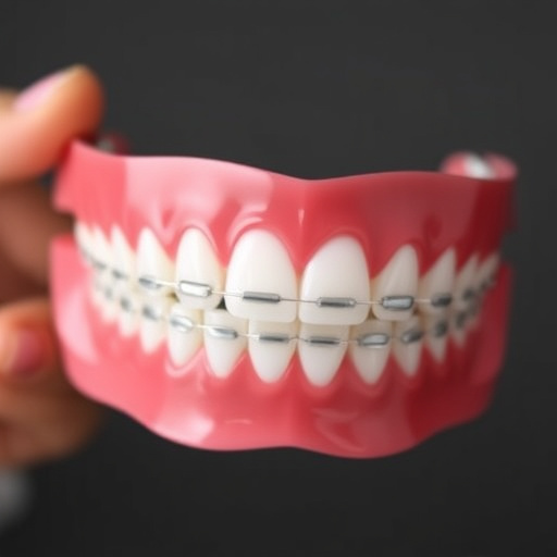 dental aligners