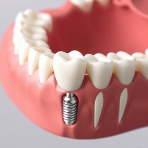 dental-implants-640x480-49063895.jpeg