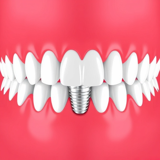 dental implants