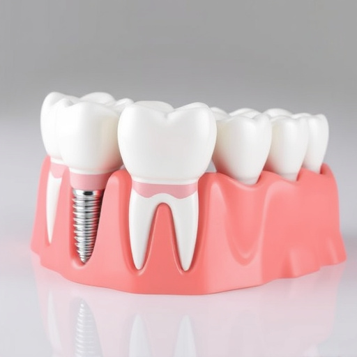 dental implants