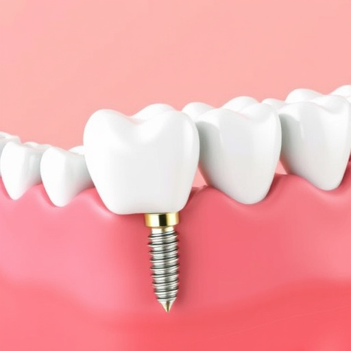dental implants
