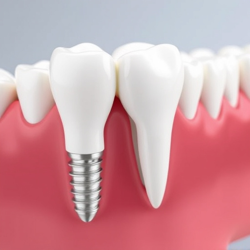 dental-implants-640x480-88537503.jpeg