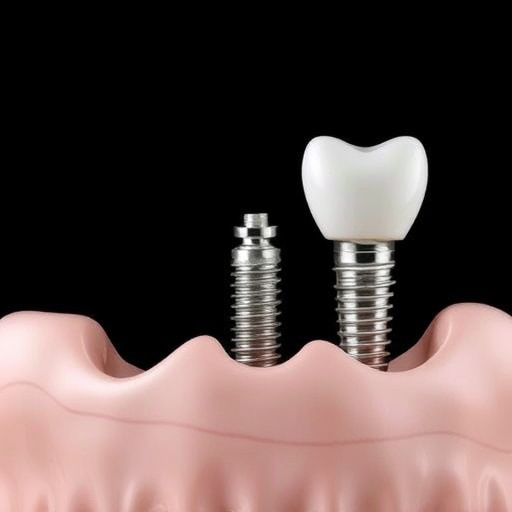 dental implants