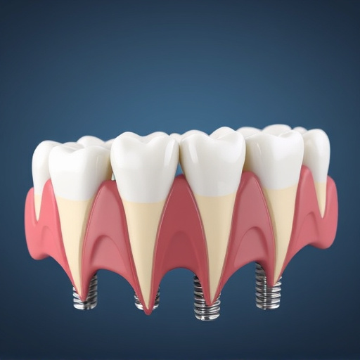 dental implants