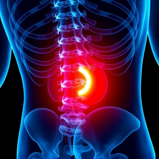 herniated disc