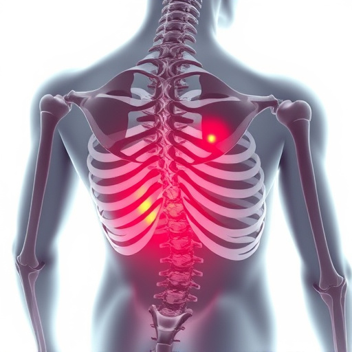 herniated disc