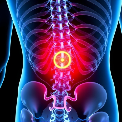 herniated disc