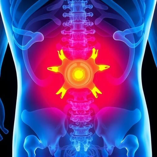 herniated disc