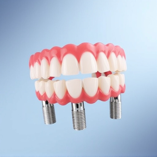 implant dentures