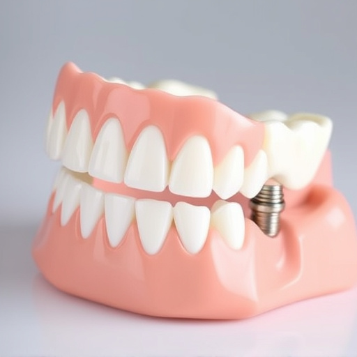 implant dentures