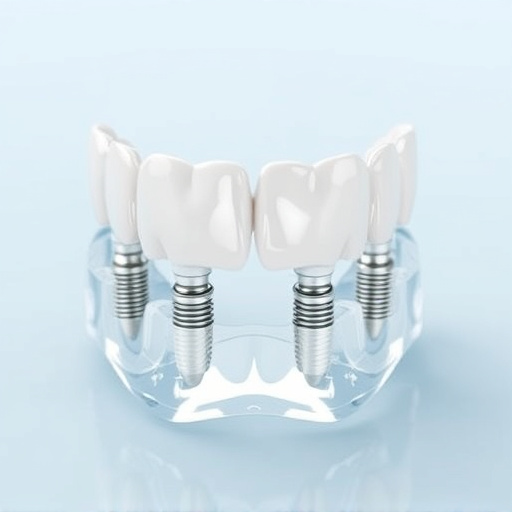 implant dentures