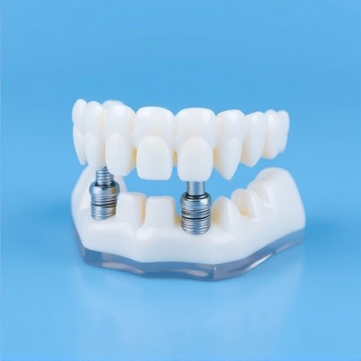 implant dentures