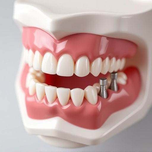 implant dentures