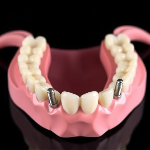 implant dentures
