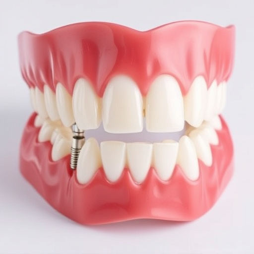 implant dentures