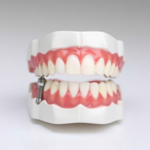 implant dentures