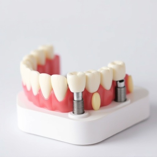 implant dentures