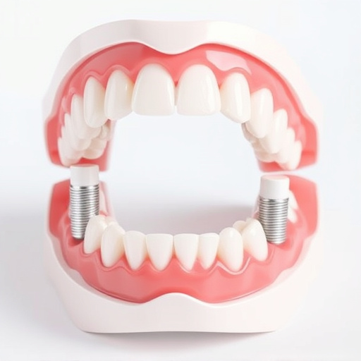 implant dentures