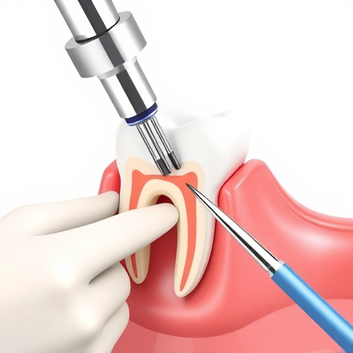 tooth-extraction-640x480-43309695.jpeg