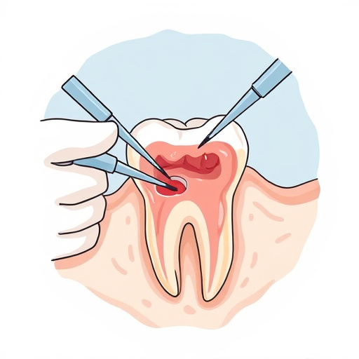 tooth-extraction-640x480-71640587.jpeg