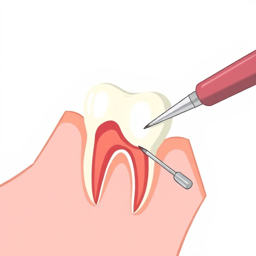 tooth extraction