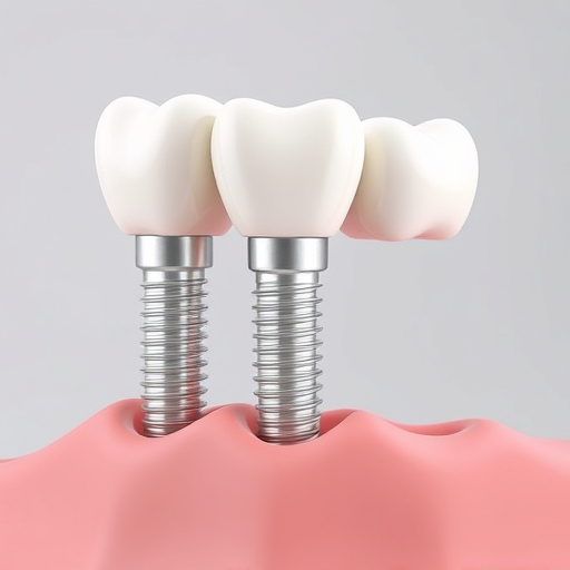 dental implants