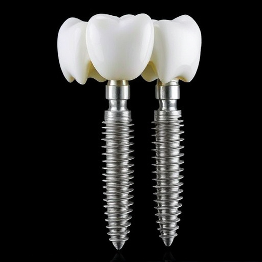 dental implants