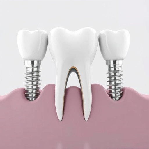 dental implants