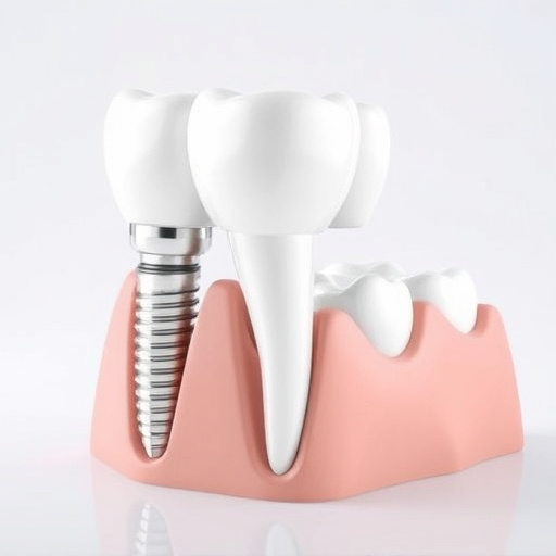 dental implants