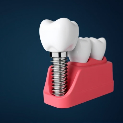 dental-implants-640x480-24539445.jpeg