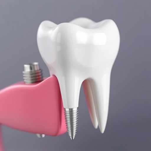 dental implants