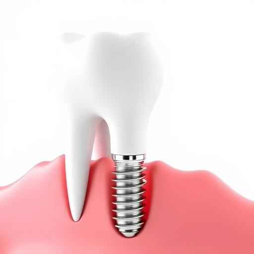 dental implants