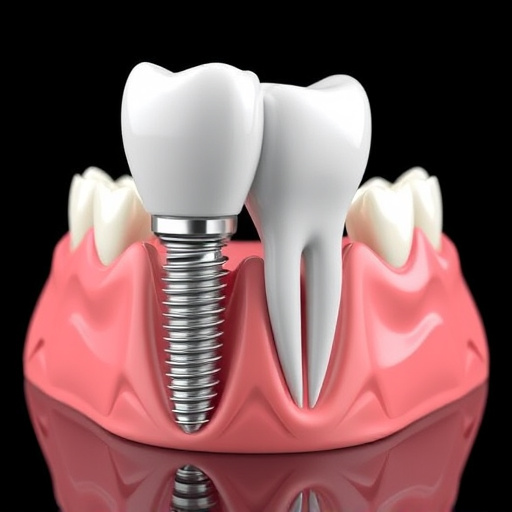 dental implants