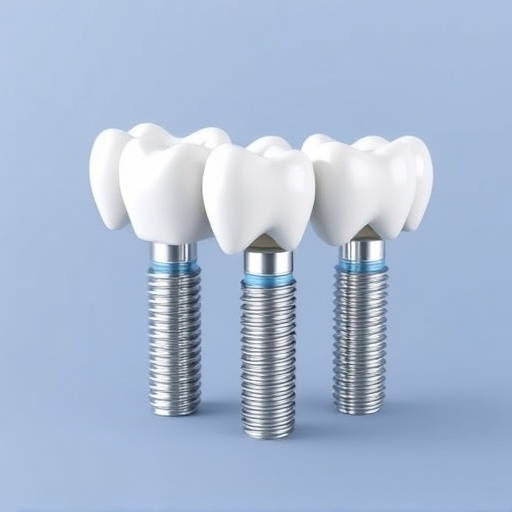 dental implants