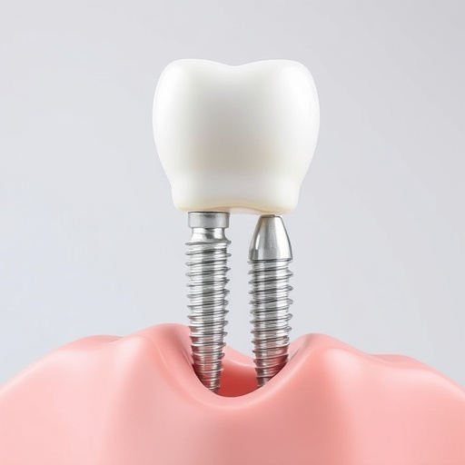 dental-implants-640x480-52909914.jpeg