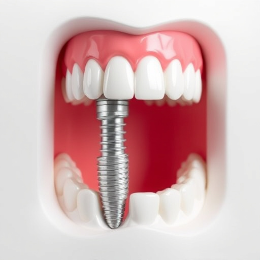 dental implants