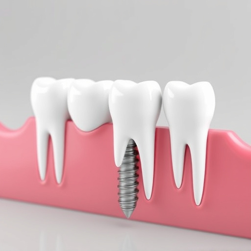 dental-implants-640x480-92211383.jpeg