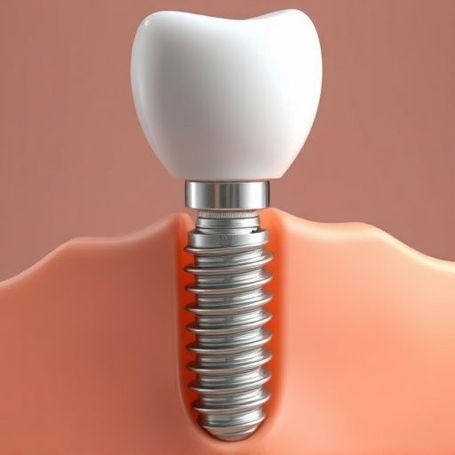 dental implants
