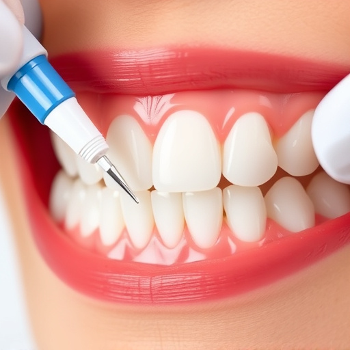 dental-sealants-640x480-66027840.jpeg