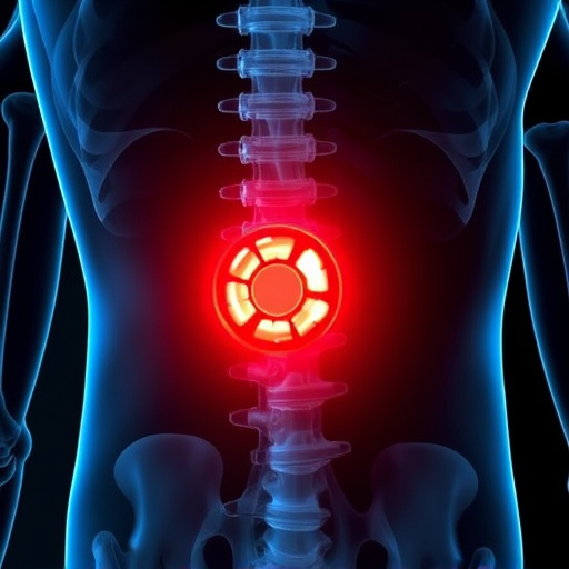 herniated disc