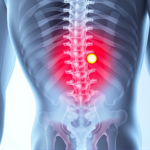 herniated disc