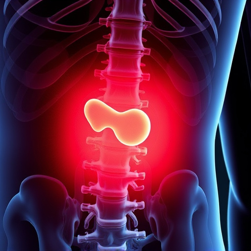 herniated-disc-640x480-18493008.jpeg