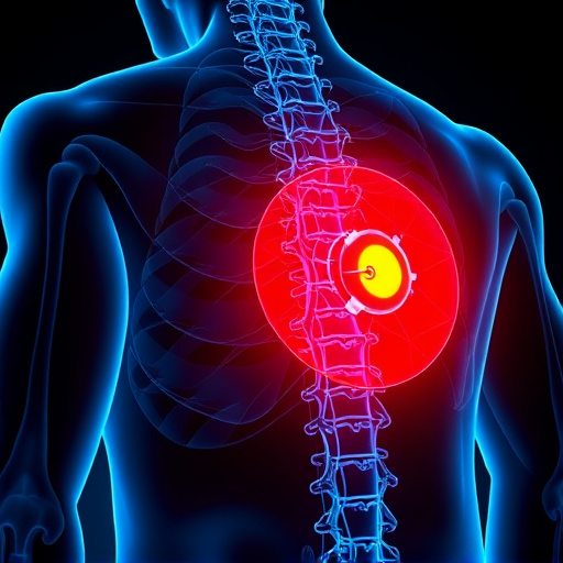 herniated disc