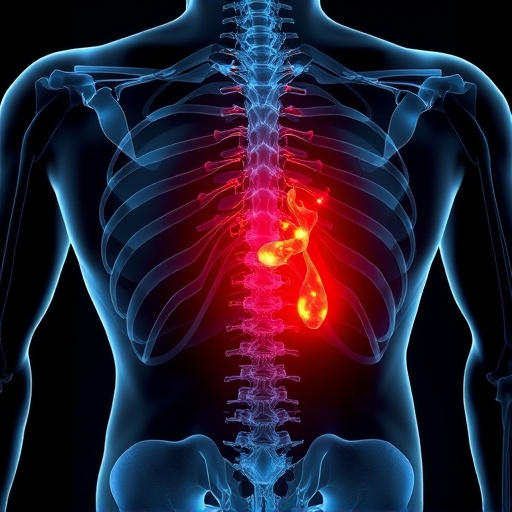 herniated disc