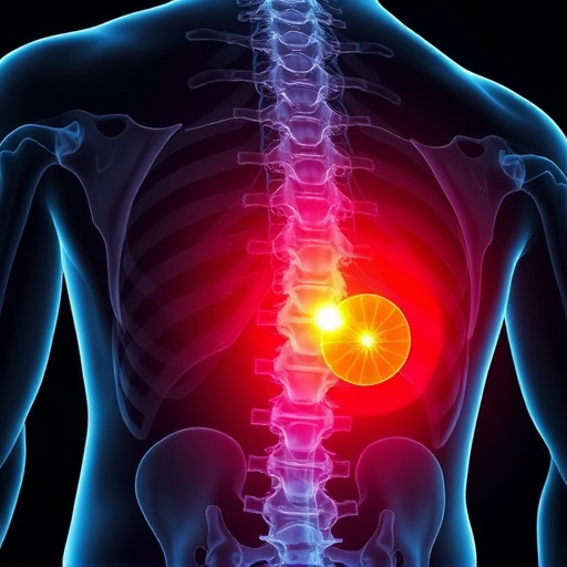 herniated disc