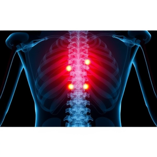 herniated disc
