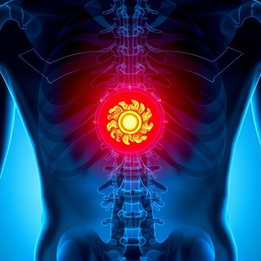 herniated disc