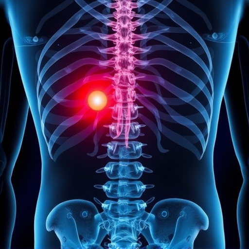 herniated disc